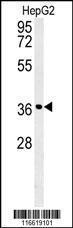 Anti-CCND1-Y226 Rabbit Polyclonal Antibody