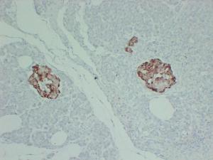 Immunohistochemical analysis of paraffin-embedded human Pancreas using Anti-TIMP1 Antibody