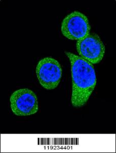 Anti-CRHR2 Rabbit Polyclonal Antibody (APC (Allophycocyanin))