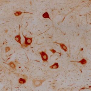 Immunohistochemistry of a section of rat facial nucleus 7 days following axotomy using Anti-Alpha-Internexin Antibody