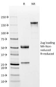 SDS-PAGE analysis of Anti-CD2 Antibody [BH1] under non-reduced and reduced conditions; showing intact IgG and intact heavy and light chains, respectively. SDS-PAGE analysis confirms the integrity and purity of the antibody.