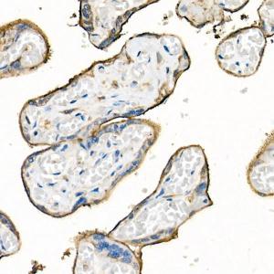 Immunohistochemistry analysis of paraffin-embedded human placenta using Anti-CD98 Antibody (A11865) at a dilution of 1:50 (40X lens). Perform high pressure antigen retrieval with 10 mM citrate buffer pH 6.0 before commencing with IHC staining protocol