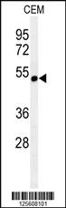 Anti-CHRNA3 Rabbit Polyclonal Antibody