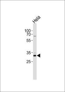 Anti-CCND1 Rabbit Polyclonal Antibody (Biotin)