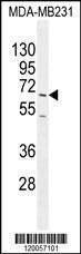 Anti-FUT8 Rabbit Polyclonal Antibody (HRP (Horseradish Peroxidase))