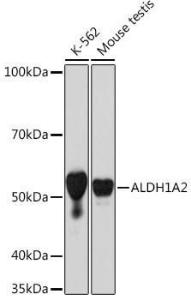 Western blot analysis of extracts of various cell lines, using Anti-ALDH1A2 Antibody [ARC1797] (A307940) at 1:1000 dilution. The secondary Antibody was Goat Anti-Rabbit IgG H&L Antibody (HRP) at 1:10000 dilution. Lysates/proteins were present at 25 µg per lane