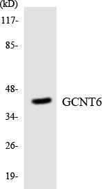 Western blot analysis of the lysates from HeLa cells using Anti-GCNT6 Antibody