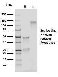 Anti-Adipophilin antibody