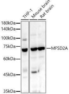 Western blot analysis of various lysates, using Anti-MFSD2A/NLS1 Antibody (A305560) at 1:1,000 dilution