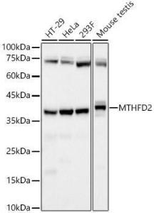 Western blot analysis of various lysates, using Anti-MTHFD2 Antibody [ARC58228] (A309411) at 1:7,000 dilution The secondary antibody was Goat Anti-Rabbit IgG H&L Antibody (HRP) at 1:10,000 dilution Lysates/proteins were present at 25 µg per lane