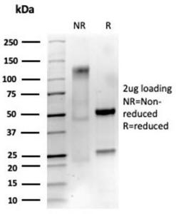 SDS-PAGE analysis of Anti-p75 NGF Receptor Antibody [NGFR/4919] under non-reduced and reduced conditions; showing intact IgG and intact heavy and light chains, respectively SDS-PAGE analysis confirms the integrity and purity of the antibody