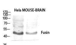 Anti-CXCR4 antibody