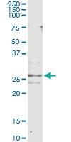 Anti-CFC1 Mouse Monoclonal Antibody [clone: 2G4]