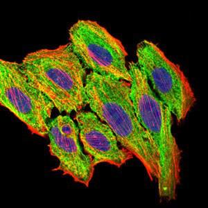 Anti-CCL2 Mouse monoclonal antibody unconjugated [clone: 2D8]