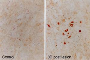 Rat facial nucleus before (left) and after (right) facial nerve lesion Note the profound upregulation of a-internexin in the facial nucleus motor neurons