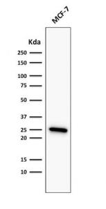 Western blot analysis of MCF-7 cell lysate using Anti-Bcl-2 Antibody [rBCL2/782]