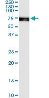 Anti-SNX33 Polyclonal Antibody Pair