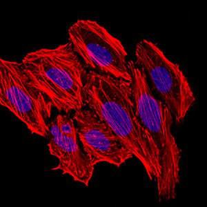 Anti-CCL2 Mouse monoclonal antibody unconjugated [clone: 2D8]