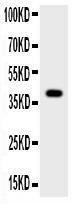 Anti-Cathepsin B Polyclonal Antibody