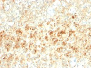 Immunohistochemical analysis of formalin-fixed, paraffin-embedded human adrenal gland using Anti-Adipophilin Antibody [ADFP/2755R]