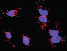 Anti-PDGFRA Mouse Monoclonal Antibody [clone: 4H1-1C9]