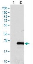 Anti-FOPNL Rabbit Polyclonal Antibody