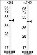 Anti-ENTPD8 Rabbit Polyclonal Antibody (PE (Phycoerythrin))