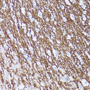 Immunohistochemistry analysis of paraffin-embedded rat brain using Anti-Contactin 1 Antibody (A306547) at a dilution of 1:100 (40X lens)