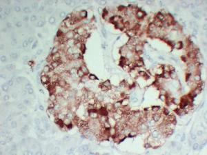 Immunohistochemical analysis of paraffin-embedded human Pancreas-high magnification using Anti-TIMP1 Antibody