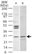 Anti-IL27 Rabbit Polyclonal Antibody