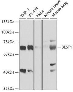 Western blot analysis of extracts of various cell lines, using Anti-Bestrophin/BEST1 Antibody (A11868) at 1:1,000 dilution