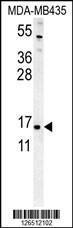 Anti-ENY2 Rabbit Polyclonal Antibody (AP (Alkaline Phosphatase))