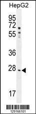 Anti-NR0B2 Rabbit Polyclonal Antibody (HRP (Horseradish Peroxidase))