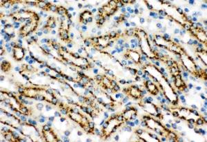 Anti-Cathepsin D Polyclonal Antibody