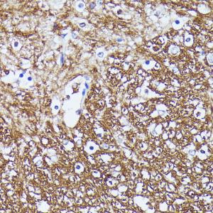 Immunohistochemistry analysis of paraffin-embedded mouse spinal cord using Anti-Contactin 1 Antibody (A306547) at a dilution of 1:100 (40X lens)