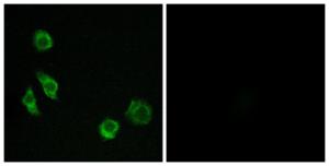 Anti-GPCR GPRC5D Rabbit Polyclonal Antibody