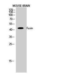 Anti-CXCR4 antibody