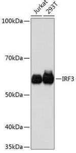 Western blot analysis of extracts of various cell lines, using Anti-IRF3 Antibody [ARC0198] (A305561) at 1:1,000 dilution. The secondary antibody was Goat Anti-Rabbit IgG H&L Antibody (HRP) at 1:10,000 dilution.