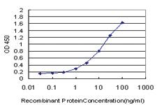 Anti-STAT5B Mouse Monoclonal Antibody [clone: 1F5]