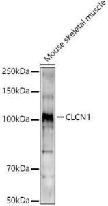 Antibody anti-CLCN1 100 µl