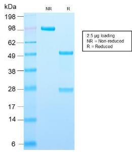 SDS-PAGE analysis of Anti-Adipophilin Antibody [ADFP/2755R] under non-reduced and reduced conditions; showing intact IgG and intact heavy and light chains, respectively. SDS-PAGE analysis confirms the integrity and purity of the antibody