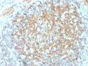 Immunohistochemical analysis of formalin-fixed, paraffin-embedded human tonsil using Anti-Integrin beta 3 Antibody [ITGB3/2145]