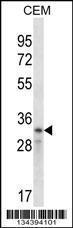 Anti-CCND2 Rabbit Polyclonal Antibody (FITC (Fluorescein Isothiocyanate))