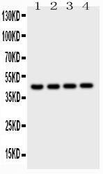 Anti-Cathepsin D Polyclonal Antibody