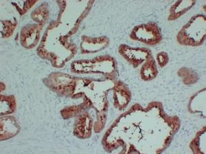 Immunohistochemical analysis of paraffin-embedded human Prostate using Anti-TIMP1 Antibody