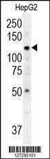 Anti-ATP13A3 Rabbit Polyclonal Antibody (PE (Phycoerythrin))