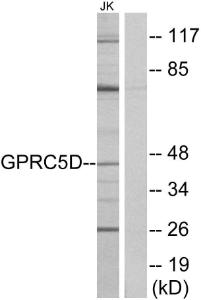 Anti-GPCR GPRC5D Rabbit Polyclonal Antibody