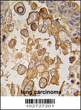 Anti-TLR6 Rabbit Polyclonal Antibody (FITC (Fluorescein))