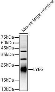 Anti-Ly6g antibody