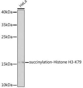 Western blot analysis of extracts of HeLa cells, using Anti-Histone H3 Antibody (A305562) at 1:1,000 dilution